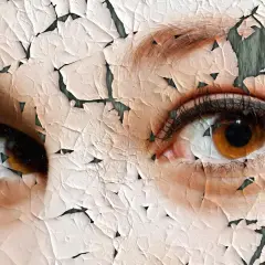 Nahaufnahme von Augen mit rissiger, trockener Hauttextur.