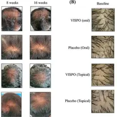 Wie viele Haare hat ein Mensch? Zahlen, Fakten & Einflussfaktoren
