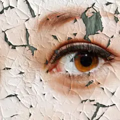 Nahaufnahme eines Auges mit rissiger, schuppiger Haut.