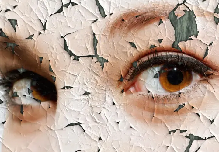 Nahaufnahme von Augen mit rissiger, trockener Hauttextur.
