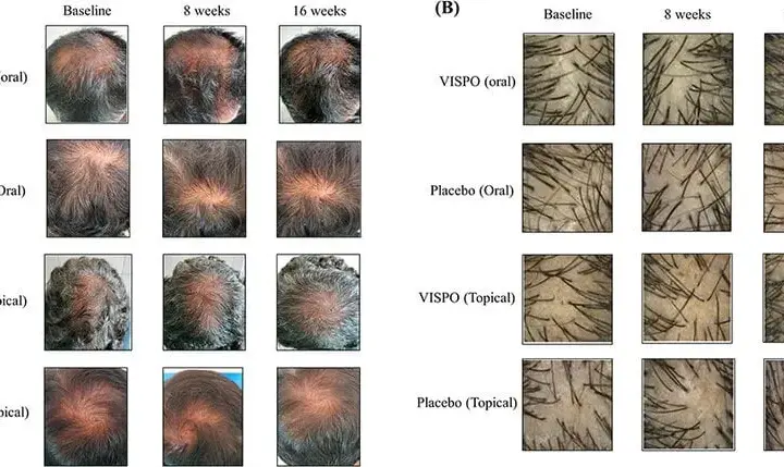 Wie viele Haare hat ein Mensch? Zahlen, Fakten & Einflussfaktoren