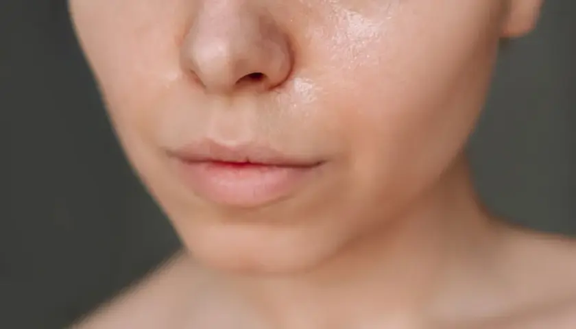 Fettige Haut: Ursachen, Pflege & Tipps für einen matten Teint