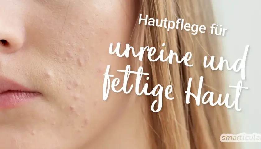 Fettige Haut: Hausmittel & Pflegetipps für reine Haut